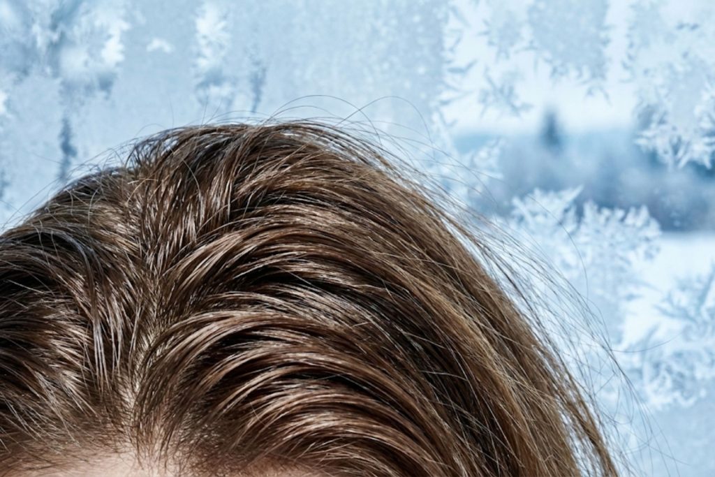 Il Paradosso dell'Inverno: Perché il Gelo Risveglia il Sebo