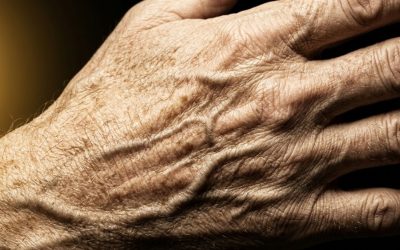 La pelle post-oncologica: dalla biologia mitocondriale alla formulazione funzionale